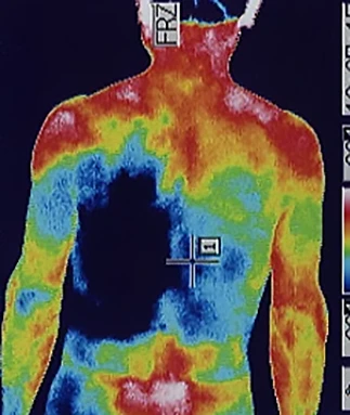 Ménière's Disease (Intractable Disease)|Thermography to Check for Immunity Deficiencies
